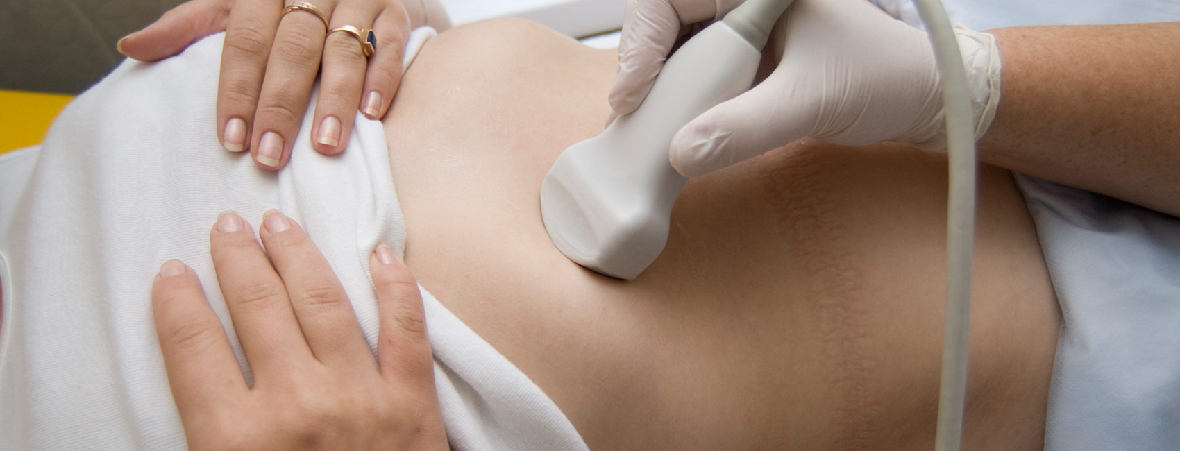 Ultrasound